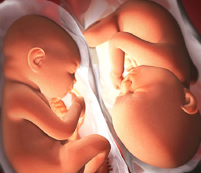 Mang song thai cũng là nguyên nhân dẫn đến thai nghén
