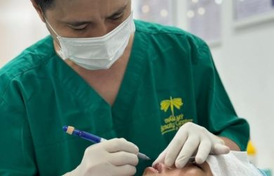 Cắt mí an toàn không để lại SẸO