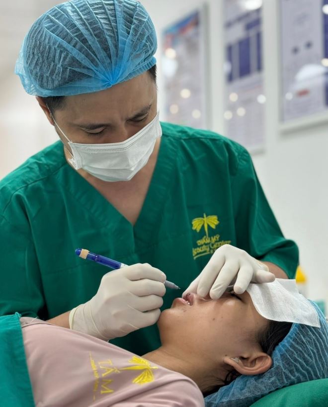 Cắt mí an toàn không để lại SẸO